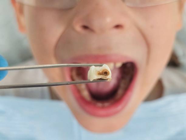 Best Emergency Dental Surgery in Desert Palms, CA
